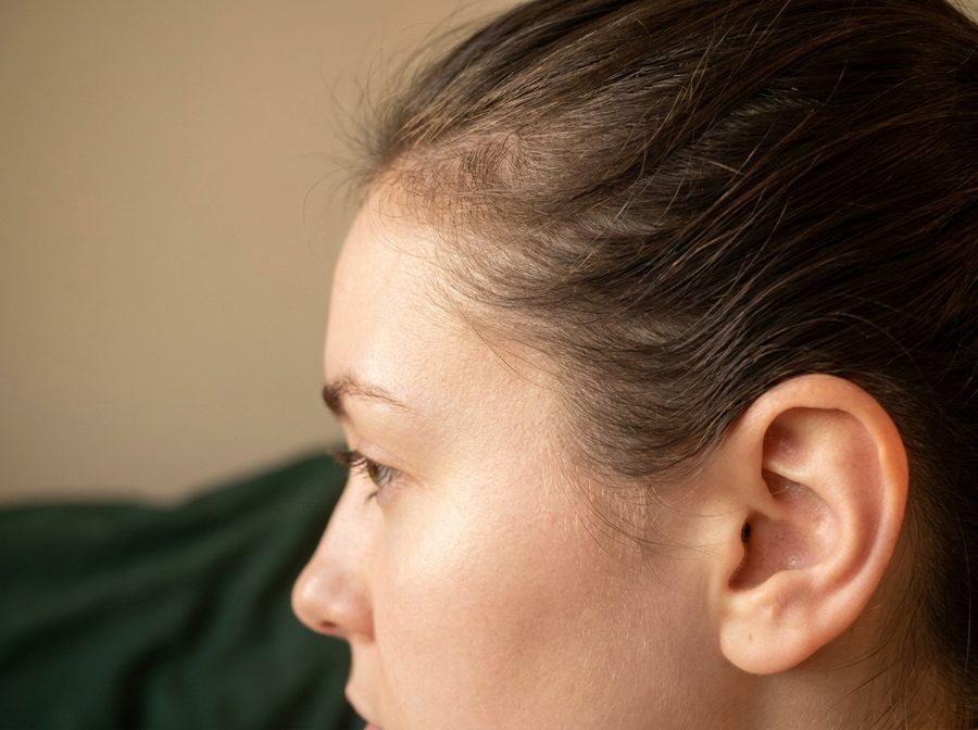Baby hairs aux tempes après 6 semaines
